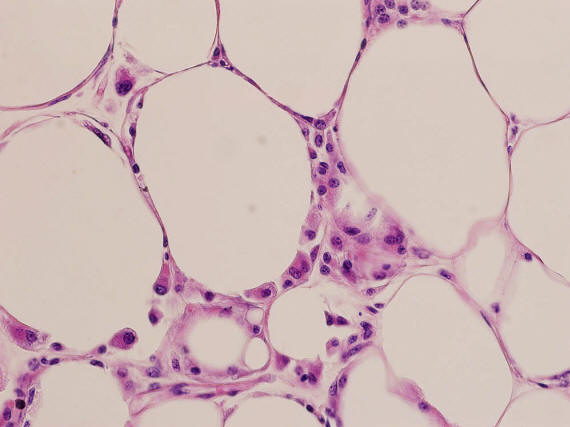 0218 10 dejstev o telesni teži