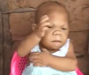 32-letna ženska ima telo enoletnega otroka.