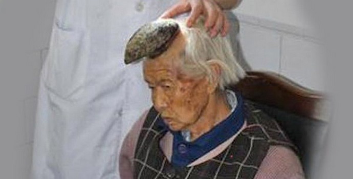 In rogovi na glavi rastejo pri ženskah