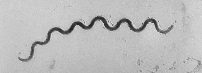 Amerika mora biti odgovorna za okužbo gvatemalskega sifilisa.