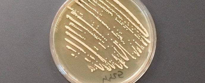 Američani vzredili kvas, ki sladkor pretvori v opij