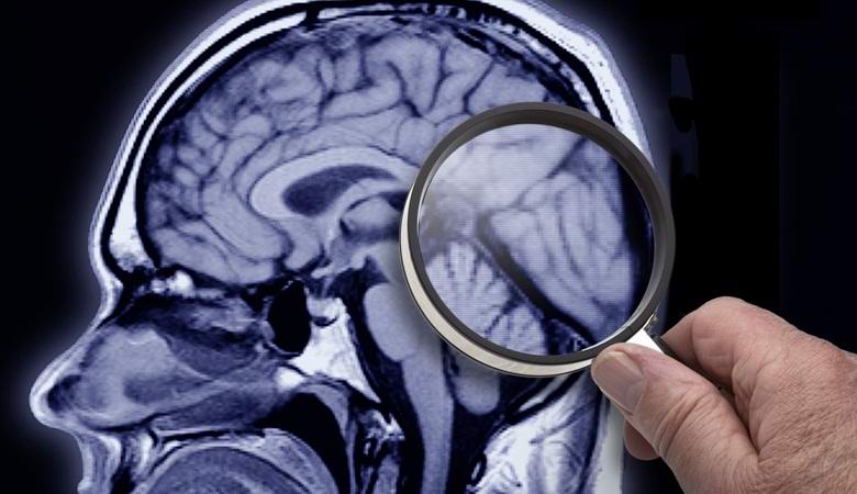 Američani bodo kmalu začeli dvigovati mrtve.