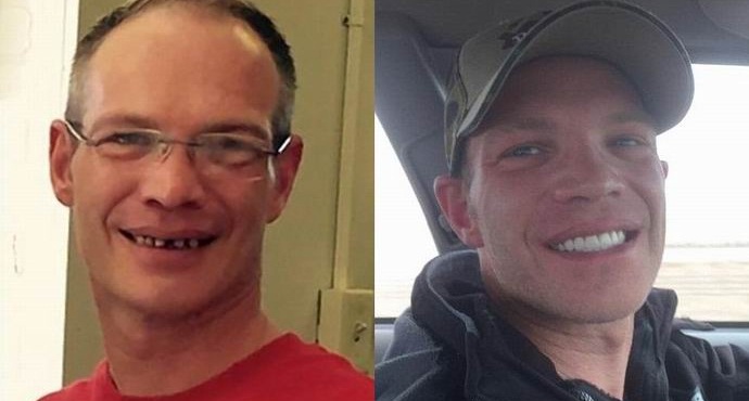 Američan je natakarju pustil petindvajset tisoč za zdravljenje zob