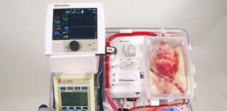 Avstralski zdravniki so se naučili presaditi ljudi z mrtvimi srci