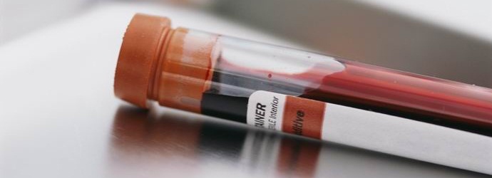 Človek ima petintrideset znanih krvnih skupin.