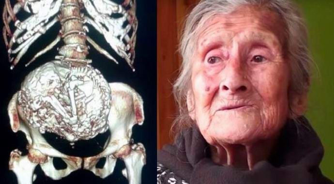 Čileanec je imel otroka šest desetletij.