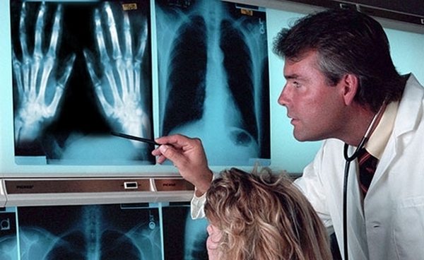 Deset najčudnejših človeških bolezni