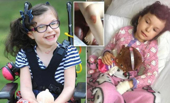 Dekle, ki ne čuti bolečine