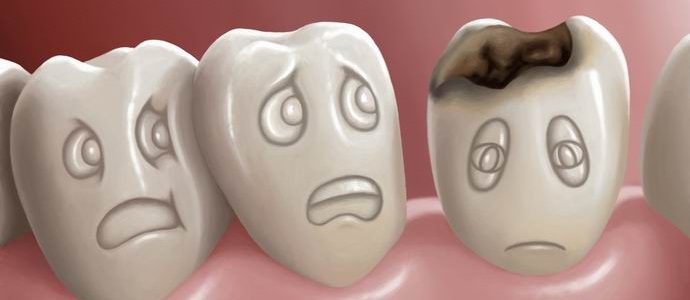 Dve in pol milijarde Zemljanov nočejo zdraviti kariesa