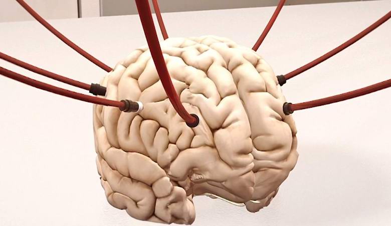 Etična razprava je izginila, potem ko so znanstveniki podprli življenje v možganih obglavljenih prašičev.