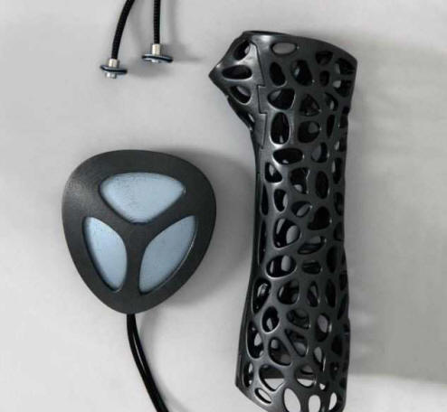 Ultrazvočni mavec ozdravi zlome za 80% hitreje.