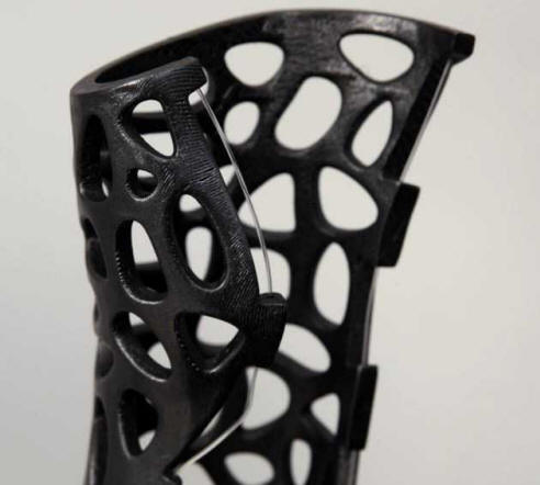 Ultrazvočni mavec ozdravi zlome za 80% hitreje.