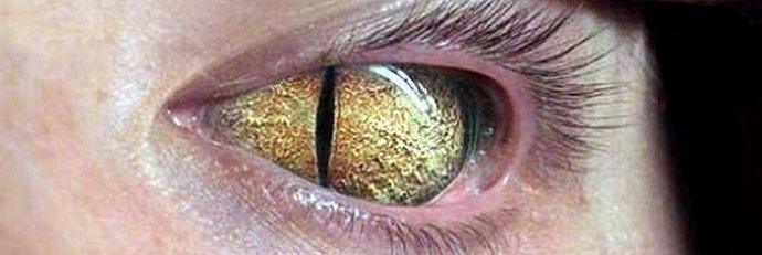 Modra kri plazilcev. Kako je Obama povezan z plazilci.