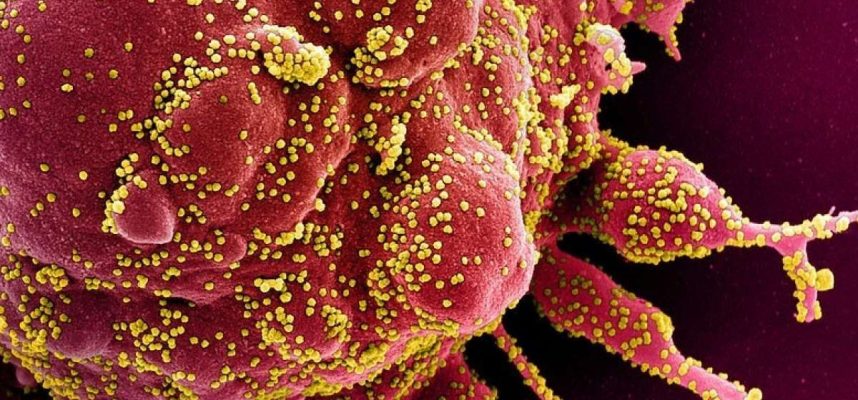 Študija kaže, da bi COVID-19 imunski sistem lahko prisilil, da se napade 