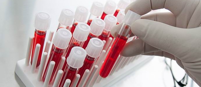 Kanadčani lahko združujejo vse krvne skupine.