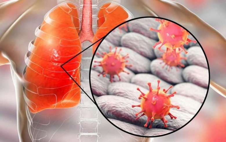 Kitajski koronavirus kot vaja globalistov (verzija)