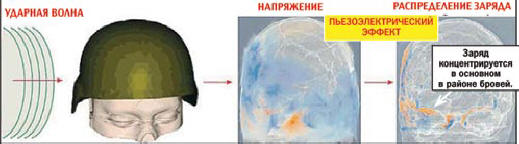 Naboj je koncentriran predvsem na področju obrvi.