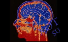 Možganski vsadki bodo človeku pomagali učinkoviteje delovati.