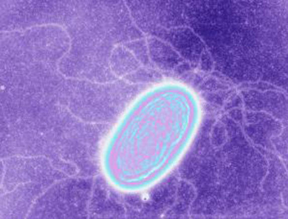 Ena izmed električnih bakterij