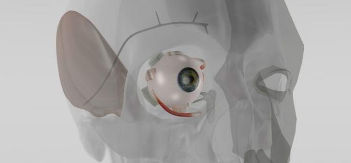 Nemci so izumili implantat za uravnavanje intraokularnega tlaka.