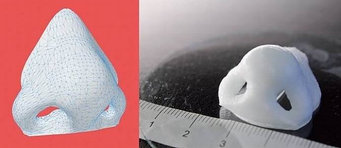 Nenavaden tiskalnik ustvarja proteze iz človeškega tkiva.