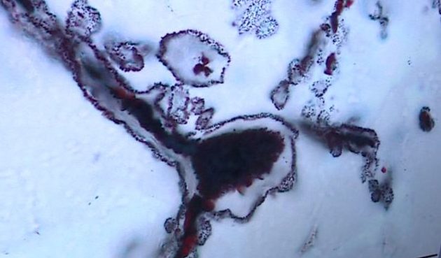 Odkriti najzgodnejši dokazi o življenju na Zemlji 