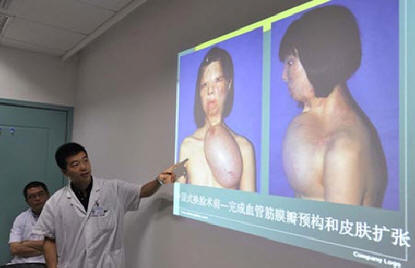 Na Kitajskem so opravili še eno šokantno plastično operacijo.