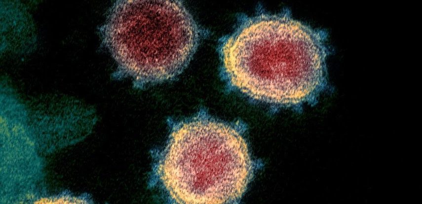 Zdravstvene oblasti pričakujejo širjenje COVID-19 v ZDA 