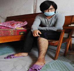 Iz medicine je mlada Kitajka poraščena z lasmi.