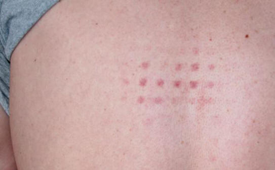 Od kod prihajajo nenavadne oznake na telesu?