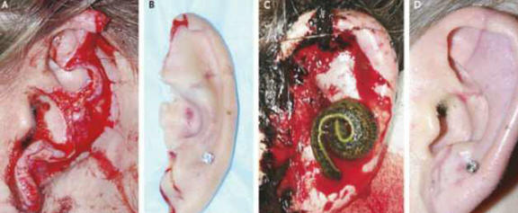 Pijavke so kirurgom pomagale obnoviti odtrgano uho psa.