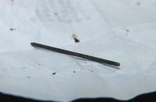 Akupunkturna igla je potovala po telesu 40-letnega moškega.