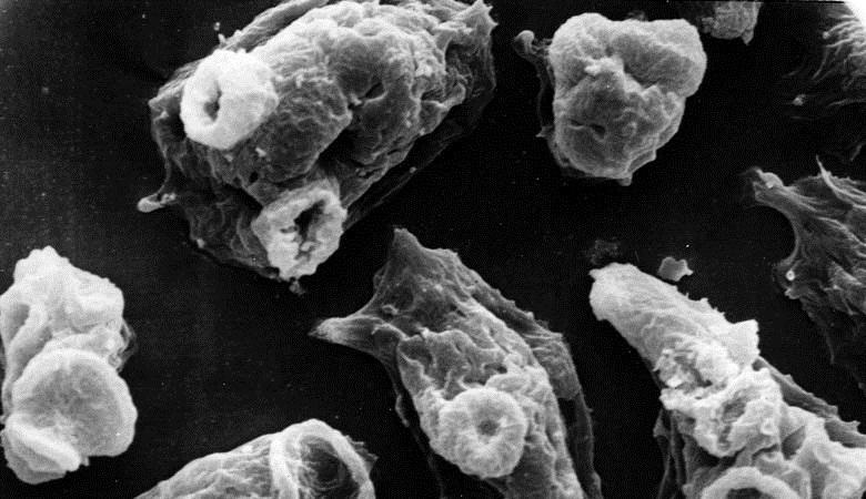 Ameba, ki jedo možgane, je v ZDA pripeljala orkan IRMA