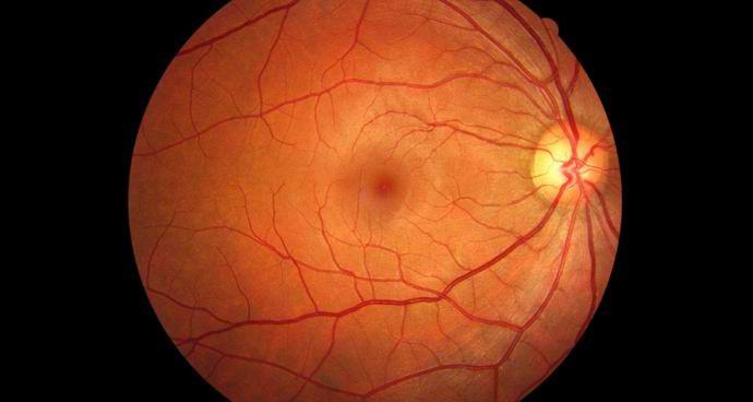 Polet na Mars lahko astronavte prikrajša za vid