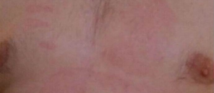 Poltergeist palma zažgala prsi Novorossiysk