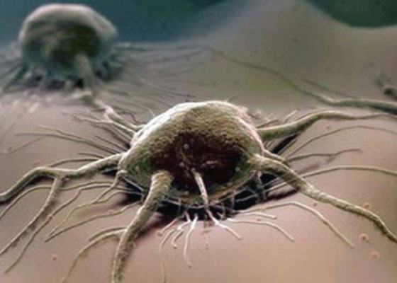 Je rak vzrok smrtne nesreče?