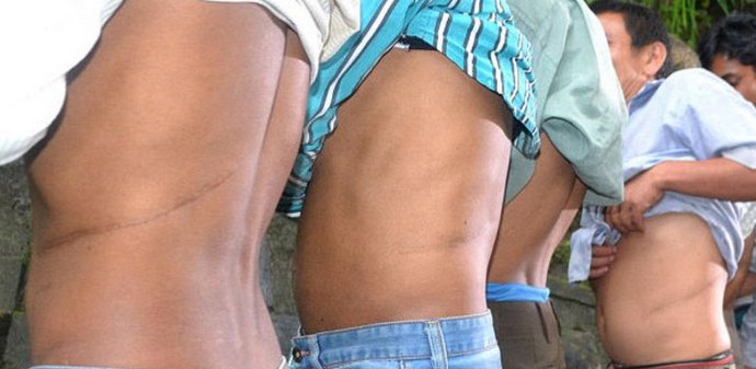 Prodajte ledvico in kupite hišo