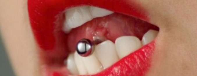 Prebil je jezik - izgubil je sprednje zobe