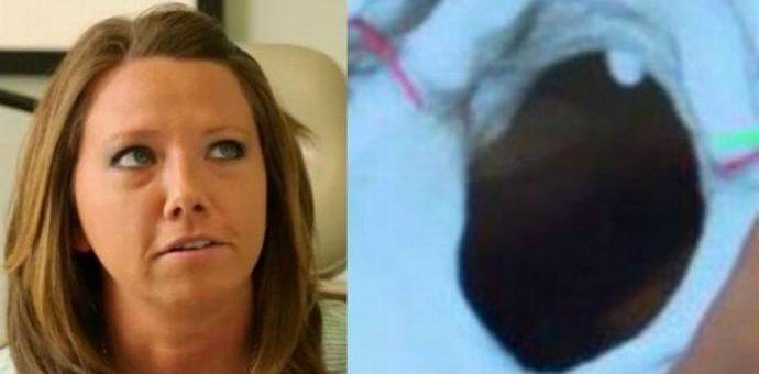 Zaradi redke bolezni Američanka zasliši svoje telesno delo.