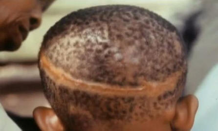 Ali so rojstni znaki povezani z nasilno smrtjo v preteklem življenju?