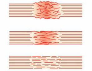 S pomočjo biološkega ročaja lahko vsako poškodbo tkiva hitro ozdravimo.