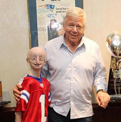 Šolar je umrl od starosti