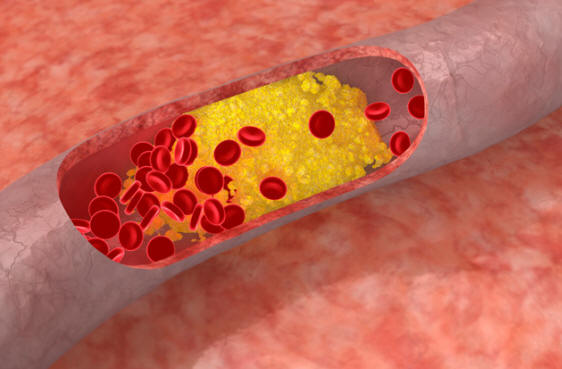 Sposobnosti, pridobljene kot posledica redkih genetskih mutacij pri ljudeh