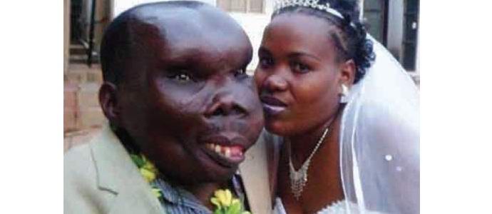 Najgrši moški v Ugandi ima osmega otroka.