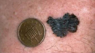 Znanstveniki so si omislili, kako  title=