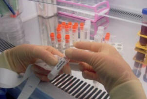 Znanstvenikom je uspelo navadne celice spremeniti v matične celice.