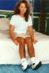 Izumljene dlakave hlačne nogavice s funkcijo proti posilstvu