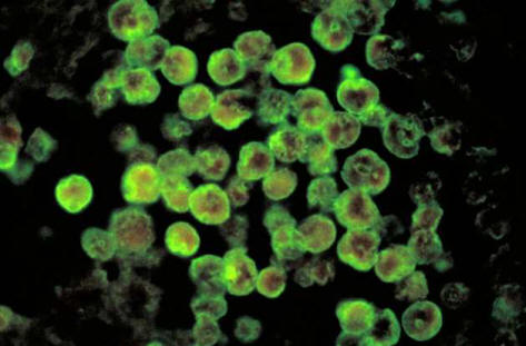 V Louisiani je voda onesnažena z amerami, ki jedo možgane.