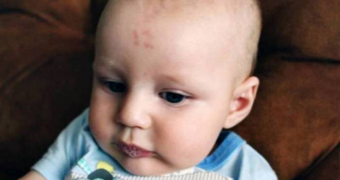 V Južni Afriki je deček označen z rojstnim žigom - številko dvanajst.