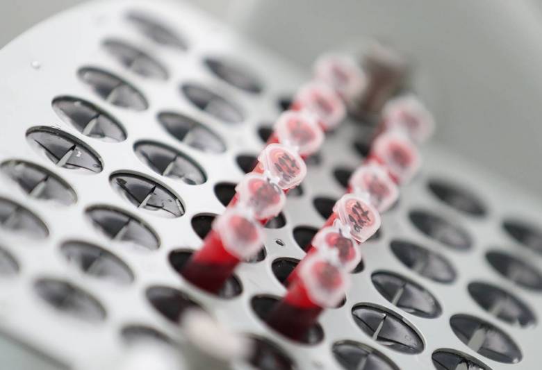 V Franciji so ugotovili, kako injicirati skozi oblačila brez brizge.